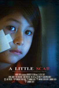 A Little Scar - (2014)